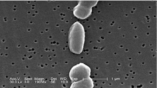بیماری نکروز حاد هپاتوپانکراس